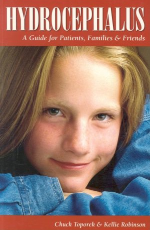 Hydrocephalus: A Guide for Patients, Families & Friends (Patient Centered Guides) Toporek, Chuck and Robinson, Kellie